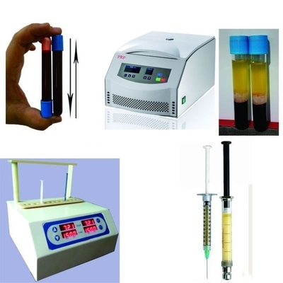 6/8x15 ml tragbare PRP-Zentrifuge 0-4000 Rpm für Kosmetische Chirurgie Krankenhäuser