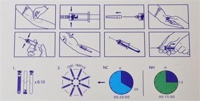 6/8x15 ml tragbare PRP-Zentrifuge 0-4000 Rpm für Kosmetische Chirurgie Krankenhäuser